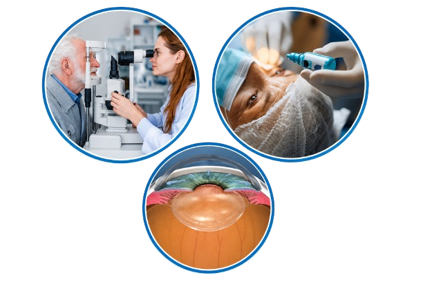 glaucoma surgery in lucknow